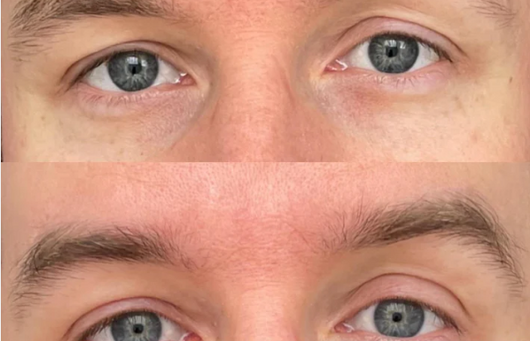 Opulent Brow Boost™